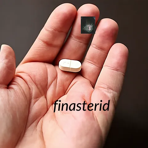 Finasteride propecia prix